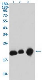 FTH1 Antibody in Western Blot (WB)