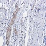 PRKCA Antibody in Immunohistochemistry (Paraffin) (IHC (P))