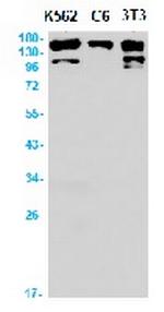 NTRK2 Recombinant Rabbit Monoclonal Antibody