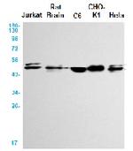 GSK3A Recombinant Rabbit Monoclonal Antibody
