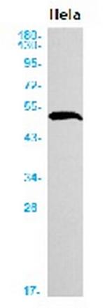 KRT18 Antibody in Western Blot (WB)