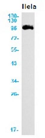 ABCG1 Recombinant Rabbit Monoclonal Antibody