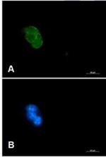 CASP3 Antibody in Immunocytochemistry (ICC/IF)