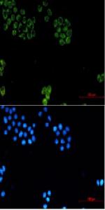 GPC1 Recombinant Rabbit Monoclonal Antibody