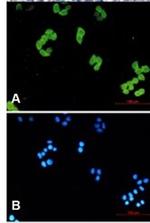 PARK7 Recombinant Rabbit Monoclonal Antibody