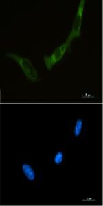Eif2Ak2 Recombinant Rabbit Monoclonal Antibody