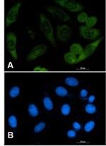 PFN1 Recombinant Rabbit Monoclonal Antibody