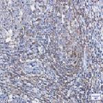 PFN1 Antibody in Immunohistochemistry (Paraffin) (IHC (P))