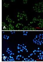 TSPO Antibody in Immunocytochemistry (ICC/IF)