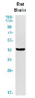 GLUL Recombinant Rabbit Monoclonal Antibody