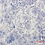 LRP1 Antibody in Immunohistochemistry (Paraffin) (IHC (P))