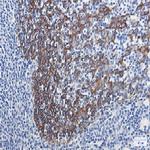 KRT16 Recombinant Rabbit Monoclonal Antibody