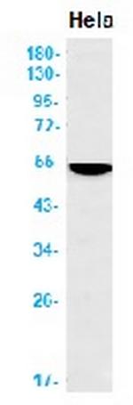 KRT16 Antibody in Western Blot (WB)
