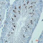 MAGEC2 Recombinant Rabbit Monoclonal Antibody