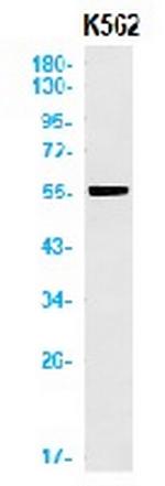 MAGEC2 Antibody in Western Blot (WB)