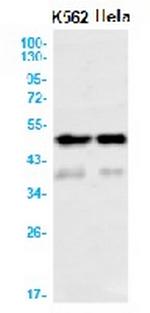 PAX6 Recombinant Rabbit Monoclonal Antibody