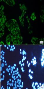 FDFT1 Recombinant Rabbit Monoclonal Antibody