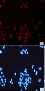MLH1 Recombinant Rabbit Monoclonal Antibody