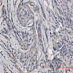 APP Antibody in Immunohistochemistry (Paraffin) (IHC (P))