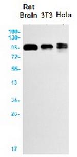 APP Antibody in Western Blot (WB)