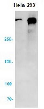ATM Antibody in Western Blot (WB)