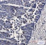 TREX1 Antibody in Immunohistochemistry (Paraffin) (IHC (P))