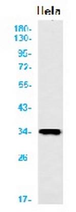 TREX1 Antibody in Western Blot (WB)