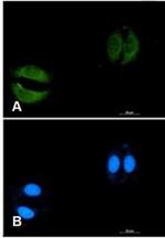 RAB5C Recombinant Rabbit Monoclonal Antibody