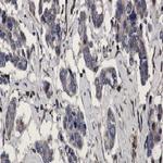 RAB5C Antibody in Immunohistochemistry (Paraffin) (IHC (P))