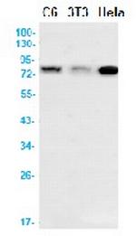 PFKM Antibody in Western Blot (WB)