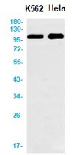 DSC3 Antibody in Western Blot (WB)