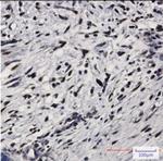 EIF2AK2 Antibody in Immunohistochemistry (Paraffin) (IHC (P))