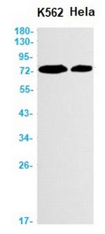 EIF2AK2 Antibody in Western Blot (WB)