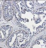 DLD Recombinant Rabbit Monoclonal Antibody