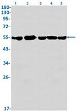 DLD Antibody in Western Blot (WB)
