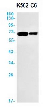 MEN1 Recombinant Rabbit Monoclonal Antibody