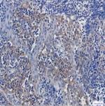 ITGAV Antibody in Immunohistochemistry (Paraffin) (IHC (P))
