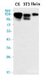 ITGAV Antibody in Western Blot (WB)