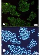 ROCK2 Antibody in Immunocytochemistry (ICC/IF)