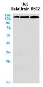 ROCK2 Antibody in Western Blot (WB)