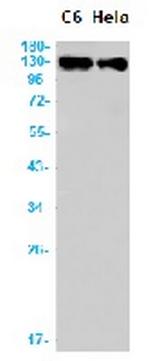 ITGAV Antibody in Western Blot (WB)