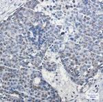 TFAM Antibody in Immunohistochemistry (Paraffin) (IHC (P))