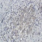 PTPN11 Recombinant Rabbit Monoclonal Antibody