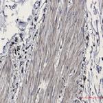 IDH1 Recombinant Rabbit Monoclonal Antibody