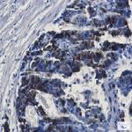 MMP14 Recombinant Rabbit Monoclonal Antibody