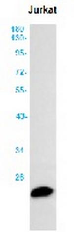 MGMT Antibody in Western Blot (WB)