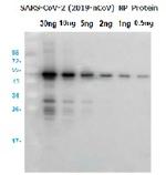 SARS-CoV-2 (2019-nCoV) Nucleoprotein/NP Antibody in Western Blot (WB)