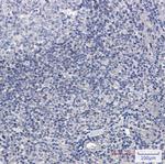 ADK Recombinant Rabbit Monoclonal Antibody