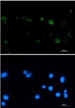 ACO2 Recombinant Rabbit Monoclonal Antibody