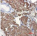 ACO2 Antibody in Immunohistochemistry (Paraffin) (IHC (P))